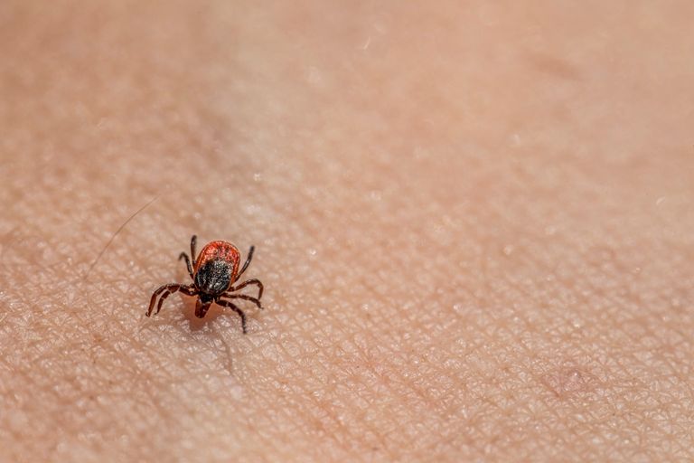 Macro image of a tick on human skin, highlighting textures and details.