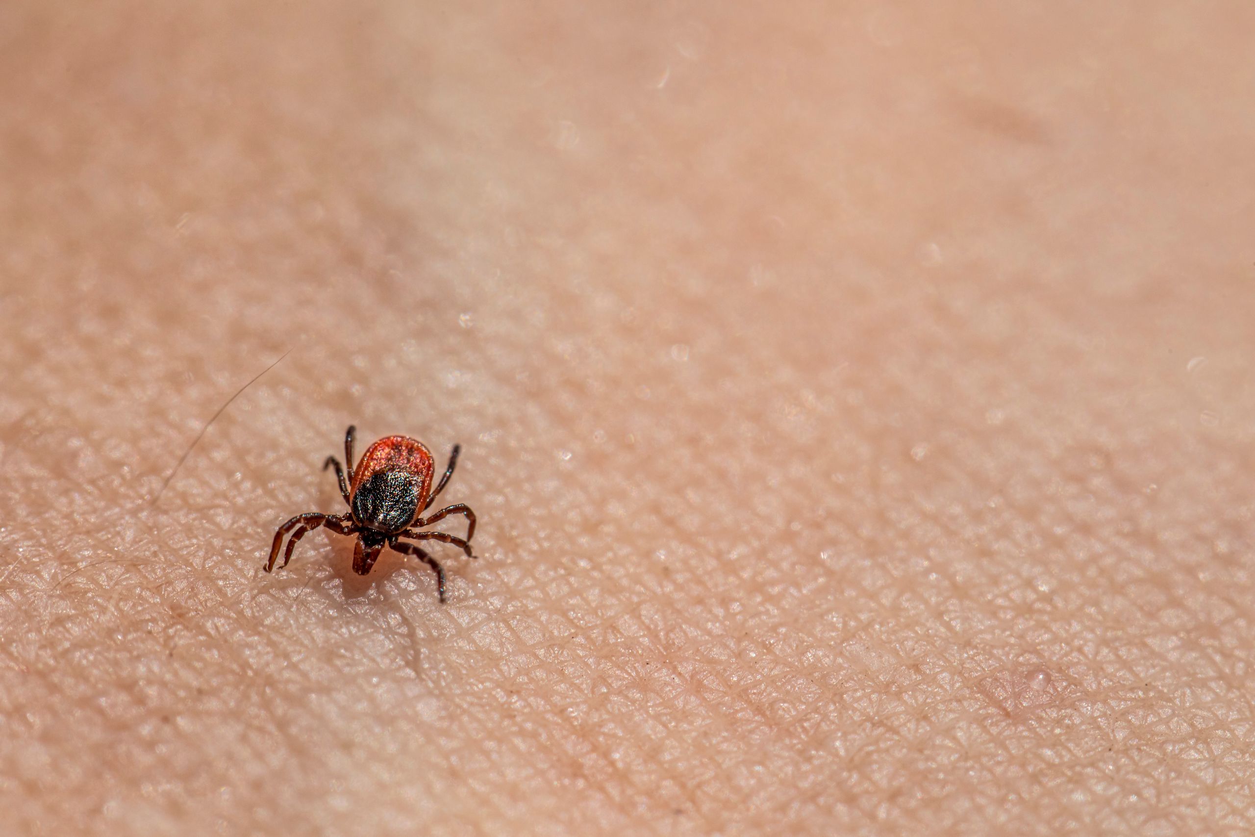 Macro image of a tick on human skin, highlighting textures and details.